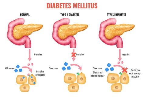 d diabetes mellitus: Best Online Casino Sites in 2026